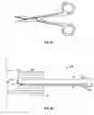 Fig. 41 - Method and apparatus for surgical dissection