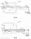 Fig. 44 - Method and apparatus for surgical dissection