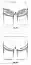 Fig. 46 - Method and apparatus for surgical dissection