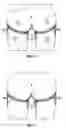 Fig. 47 - Method and apparatus for surgical dissection