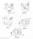 Fig. 02 - Rotating Interspinous Device