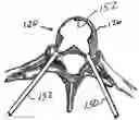 Fig. 01 - Dual incision disc repair device and method