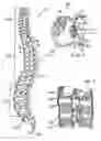 Fig. 02 - Dual incision disc repair device and method