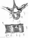 Fig. 03 - Dual incision disc repair device and method