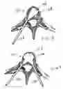 Fig. 05 - Dual incision disc repair device and method