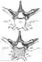 Fig. 06 - Dual incision disc repair device and method