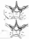 Fig. 08 - Dual incision disc repair device and method