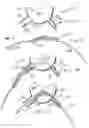 Fig. 10 - Dual incision disc repair device and method