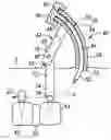 Fig. 01 - Instruments and methods for minimally invasive insertion of dynamic implants