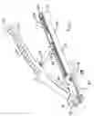 Fig. 05 - Securing device to secure fixation devices to bone portions