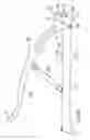 Fig. 07 - Securing device to secure fixation devices to bone portions
