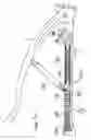 Fig. 08 - Securing device to secure fixation devices to bone portions