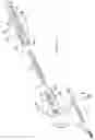 Fig. 14 - Securing device to secure fixation devices to bone portions