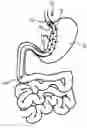 Fig. 01 - Medical Device and Method For Controlling Obesity