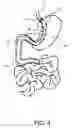 Fig. 05 - Medical Device and Method For Controlling Obesity