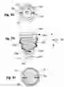 Fig. 03 - Vaginal spring loaded delineator