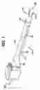 Fig. 02 - Device for plicating and fastening gastric tissue