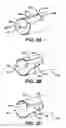 Fig. 04 - Device for plicating and fastening gastric tissue