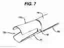 Fig. 07 - Device for plicating and fastening gastric tissue