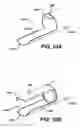 Fig. 09 - Device for plicating and fastening gastric tissue