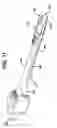 Fig. 10 - Device for plicating and fastening gastric tissue