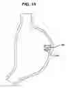 Fig. 14 - Device for plicating and fastening gastric tissue