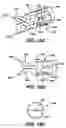 Fig. 17 - Device for plicating and fastening gastric tissue