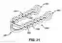 Fig. 20 - Device for plicating and fastening gastric tissue