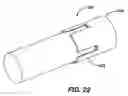 Fig. 21 - Device for plicating and fastening gastric tissue