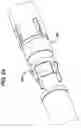 Fig. 23 - Device for plicating and fastening gastric tissue