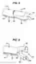 Fig. 06 - Device for plicating and fastening gastric tissue