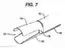 Fig. 07 - Device for plicating and fastening gastric tissue