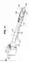 Fig. 10 - Device for plicating and fastening gastric tissue