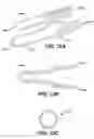 Fig. 11 - Device for plicating and fastening gastric tissue