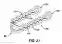 Fig. 20 - Device for plicating and fastening gastric tissue