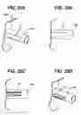 Fig. 24 - Device for plicating and fastening gastric tissue
