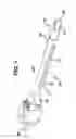 Fig. 02 - Device for plicating and fastening gastric tissue