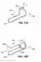 Fig. 09 - Device for plicating and fastening gastric tissue