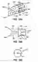 Fig. 17 - Device for plicating and fastening gastric tissue