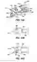 Fig. 18 - Device for plicating and fastening gastric tissue