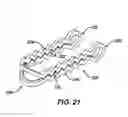 Fig. 20 - Device for plicating and fastening gastric tissue