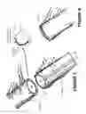 Fig. 06 - Medical device for applying purse string sutures