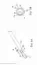 Fig. 05 - ANASTOMOSIS SYSTEMS AND METHODS