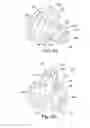 Fig. 12 - ANASTOMOSIS SYSTEMS AND METHODS