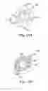 Fig. 23 - ANASTOMOSIS SYSTEMS AND METHODS