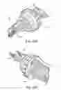 Fig. 30 - ANASTOMOSIS SYSTEMS AND METHODS