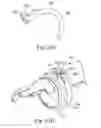 Fig. 31 - ANASTOMOSIS SYSTEMS AND METHODS