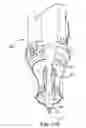Fig. 48 - ANASTOMOSIS SYSTEMS AND METHODS