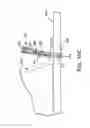 Fig. 55 - ANASTOMOSIS SYSTEMS AND METHODS