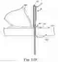 Fig. 61 - ANASTOMOSIS SYSTEMS AND METHODS